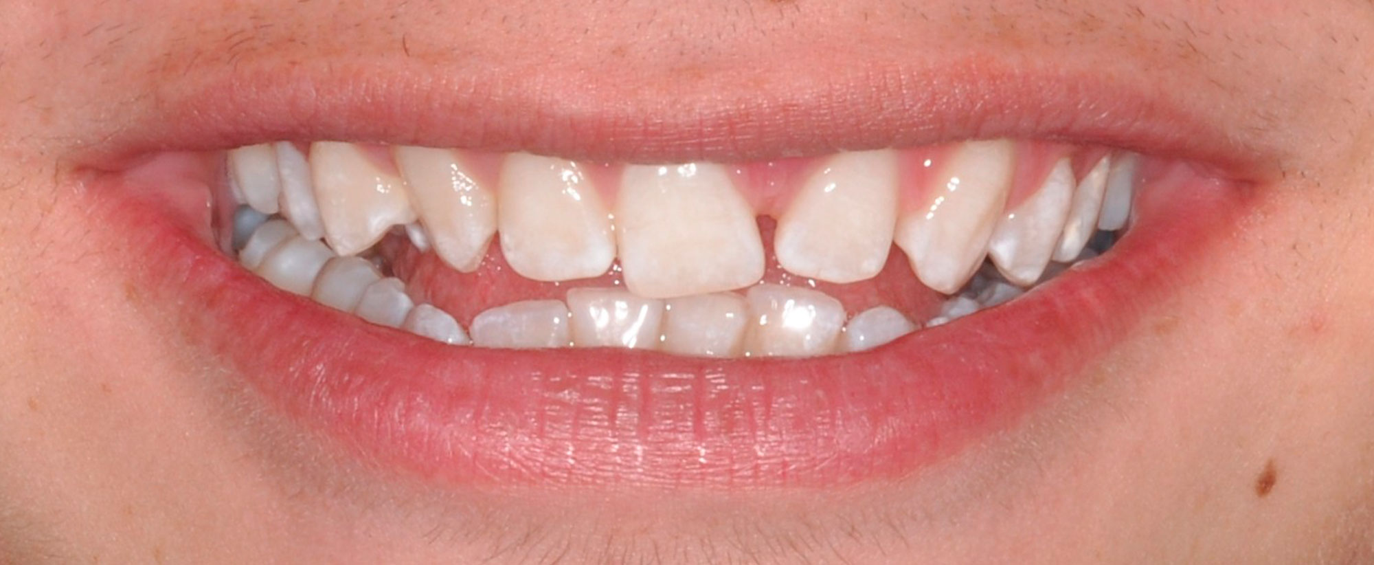 Sonrisa-Inicial-1