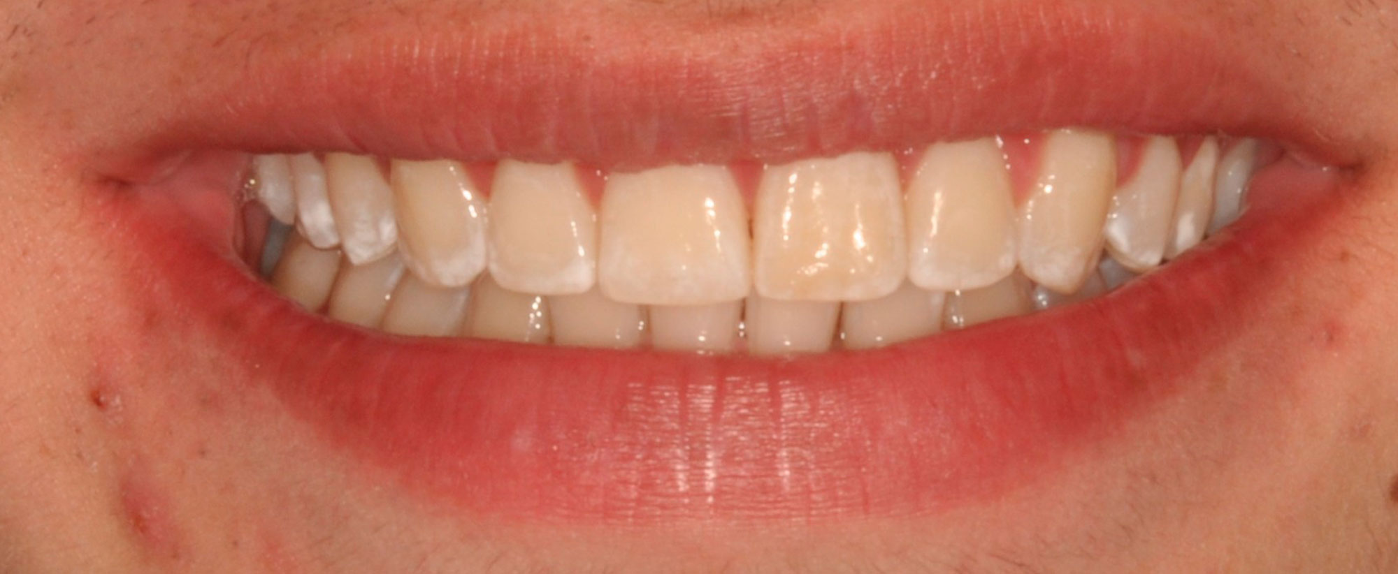 Sonrisa-final-1